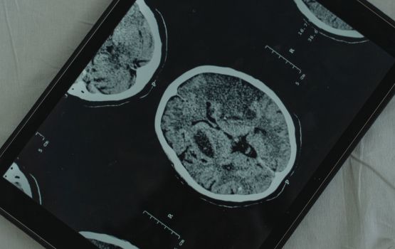 Neuromarketing : comment booster efficacement vos ventes digitales ?